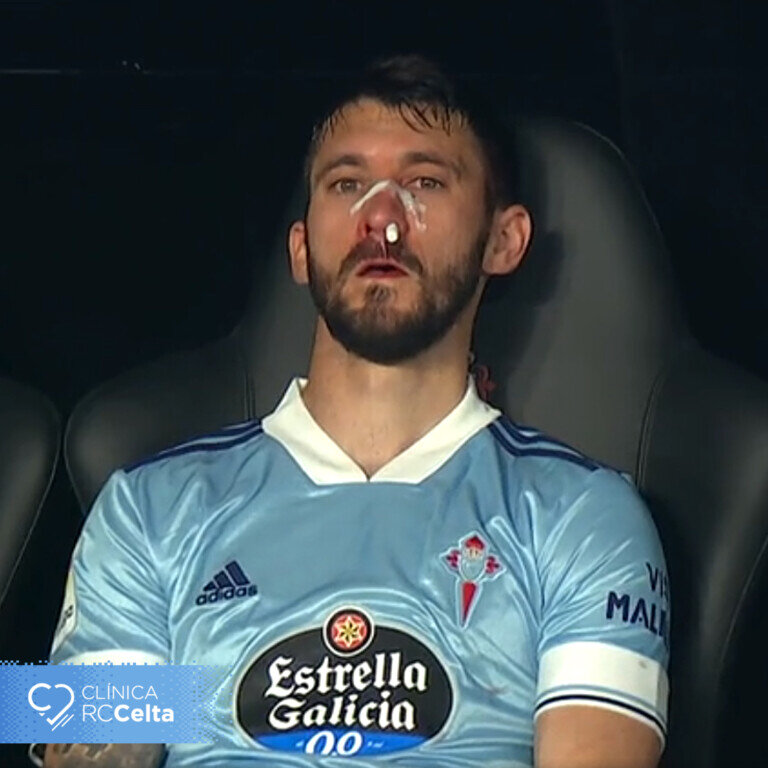 facundo ferreyra ig